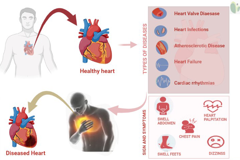 Cardiac Diseases | Revita