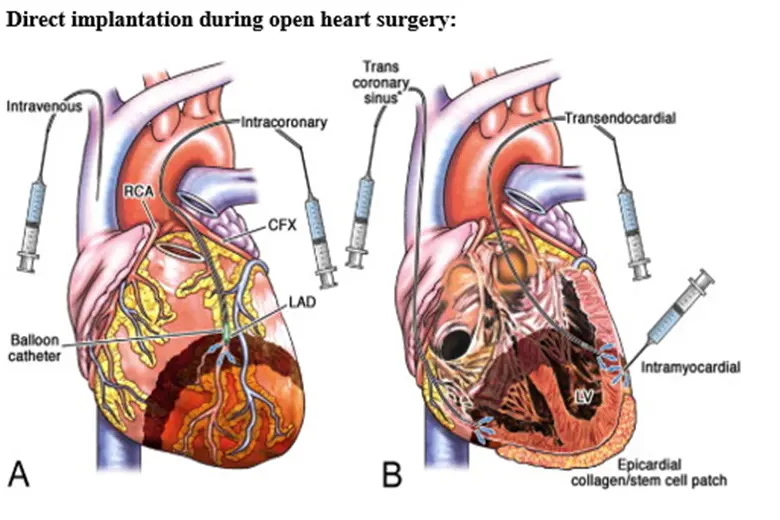 heart